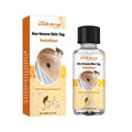 Skin Warts Removal Flat Warts Facial